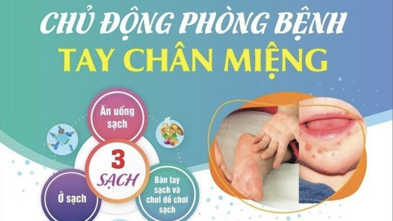 cách phòng bệnh tay chân miệng