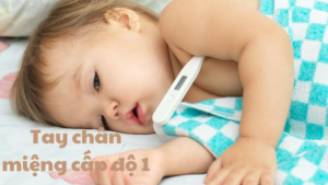 tay chân miệng cấp độ 1