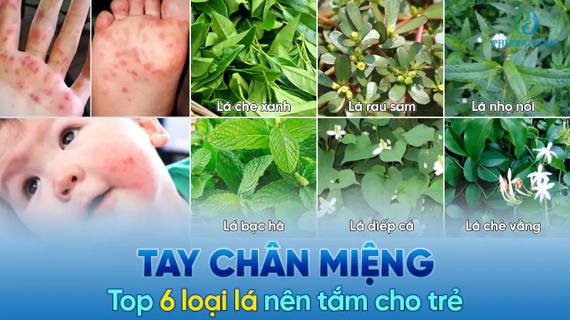 tay chân miệng tắm lá gì