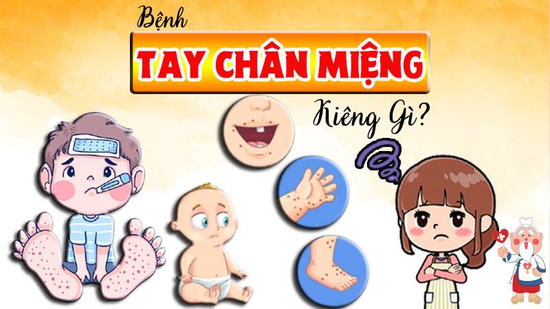 tay chân miệng kiêng gì